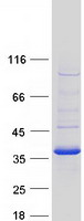 CBR3 Protein - Purified recombinant protein CBR3 was analyzed by SDS-PAGE gel and Coomassie Blue Staining