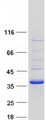 CBR3 Protein - Purified recombinant protein CBR3 was analyzed by SDS-PAGE gel and Coomassie Blue Staining