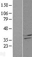 CBR4 Protein - Western validation with an anti-DDK antibody * L: Control HEK293 lysate R: Over-expression lysate