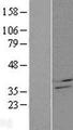 CBR4 Protein - Western validation with an anti-DDK antibody * L: Control HEK293 lysate R: Over-expression lysate