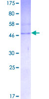 CBR4 Protein - 12.5% SDS-PAGE of human CBR4 stained with Coomassie Blue
