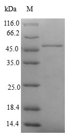 CBR4 Protein - (Tris-Glycine gel) Discontinuous SDS-PAGE (reduced) with 5% enrichment gel and 15% separation gel.