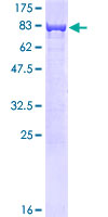 CBS Protein - 12.5% SDS-PAGE of human CBS stained with Coomassie Blue