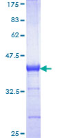 CBS Protein - 12.5% SDS-PAGE Stained with Coomassie Blue.