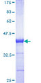 CBS Protein - 12.5% SDS-PAGE Stained with Coomassie Blue.