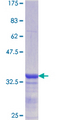 CBS Protein - 12.5% SDS-PAGE Stained with Coomassie Blue.