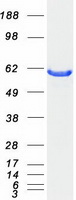 CBS Protein - Purified recombinant protein CBS was analyzed by SDS-PAGE gel and Coomassie Blue Staining