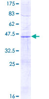 CBT1 / SDHD Protein - 12.5% SDS-PAGE of human SDHD stained with Coomassie Blue