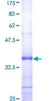 CBT1 / SDHD Protein - 12.5% SDS-PAGE Stained with Coomassie Blue.