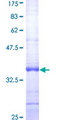CBT1 / SDHD Protein - 12.5% SDS-PAGE Stained with Coomassie Blue.