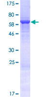 CBWD1 Protein - 12.5% SDS-PAGE of human CBWD1 stained with Coomassie Blue