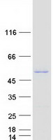 CBWD3 Protein - Purified recombinant protein CBWD3 was analyzed by SDS-PAGE gel and Coomassie Blue Staining