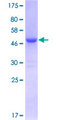 CBX1 / HP1 Beta Protein - 12.5% SDS-PAGE of human CBX1 stained with Coomassie Blue