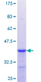 CBX1 / HP1 Beta Protein - 12.5% SDS-PAGE Stained with Coomassie Blue.