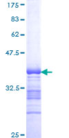 CBX2 Protein - 12.5% SDS-PAGE Stained with Coomassie Blue.