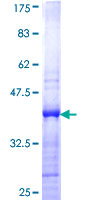 CBX2 Protein - 12.5% SDS-PAGE Stained with Coomassie Blue.