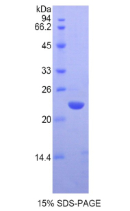 CBX3 / HP1 Gamma Protein - Recombinant Chromobox Homolog 3 By SDS-PAGE