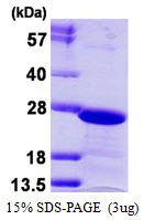 CBX3 / HP1 Gamma Protein