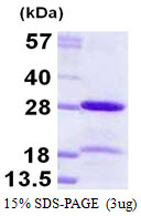 CBX5 / HP1 Alpha Protein