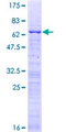 CBX7 Protein - 12.5% SDS-PAGE of human CBX7 stained with Coomassie Blue