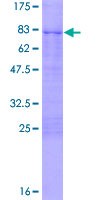 CBX8 Protein - 12.5% SDS-PAGE of human CBX8 stained with Coomassie Blue