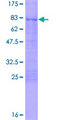 CBX8 Protein - 12.5% SDS-PAGE of human CBX8 stained with Coomassie Blue