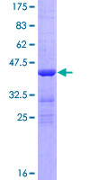 CBY1 / PGEA1 Protein - 12.5% SDS-PAGE of human CBY1 stained with Coomassie Blue