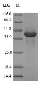 CBY1 / PGEA1 Protein - (Tris-Glycine gel) Discontinuous SDS-PAGE (reduced) with 5% enrichment gel and 15% separation gel.