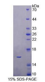 CBY1 / PGEA1 Protein - Recombinant Chibby Homolog 1 By SDS-PAGE