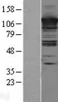 CC2D1A Protein - Western validation with an anti-DDK antibody * L: Control HEK293 lysate R: Over-expression lysate