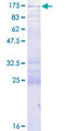 CC2D1A Protein - 12.5% SDS-PAGE of human CC2D1A stained with Coomassie Blue
