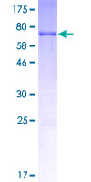 CCAR2 / KIAA1967 Protein - 12.5% SDS-PAGE of human KIAA1967 stained with Coomassie Blue