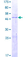 CCBE1 Protein - 12.5% SDS-PAGE of human CCBE1 stained with Coomassie Blue