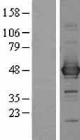 CCBL1 Protein - Western validation with an anti-DDK antibody * L: Control HEK293 lysate R: Over-expression lysate