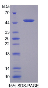 CCBL1 Protein - Recombinant Cysteine Conjugate Beta Lyase, Cytoplasmic By SDS-PAGE