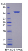 CCBL1 Protein - Recombinant Cysteine Conjugate Beta Lyase, Cytoplasmic By SDS-PAGE