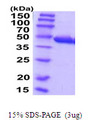 CCBL1 Protein