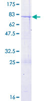 CCBL2 Protein - 12.5% SDS-PAGE of human CCBL2 stained with Coomassie Blue