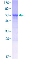 CCDC102B Protein - 12.5% SDS-PAGE of human CCDC102B stained with Coomassie Blue