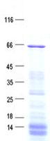 CCDC102B Protein