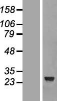 CCDC103 Protein - Western validation with an anti-DDK antibody * L: Control HEK293 lysate R: Over-expression lysate