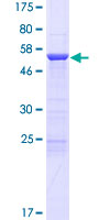 CCDC103 Protein - 12.5% SDS-PAGE of human CCDC103 stained with Coomassie Blue