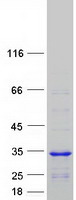 CCDC103 Protein - Purified recombinant protein CCDC103 was analyzed by SDS-PAGE gel and Coomassie Blue Staining