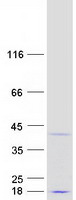 CCDC106 Protein - Purified recombinant protein CCDC106 was analyzed by SDS-PAGE gel and Coomassie Blue Staining