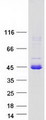CCDC107 Protein - Purified recombinant protein CCDC107 was analyzed by SDS-PAGE gel and Coomassie Blue Staining