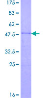 CCDC108 Protein - 12.5% SDS-PAGE of human CCDC108 stained with Coomassie Blue