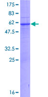 CCDC108 Protein - 12.5% SDS-PAGE of human CCDC108 stained with Coomassie Blue