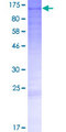CCDC110 Protein - 12.5% SDS-PAGE of human CCDC110 stained with Coomassie Blue