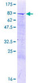 CCDC112 / MBC1 Protein - 12.5% SDS-PAGE of human CCDC112 stained with Coomassie Blue