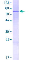 CCDC113 Protein - 12.5% SDS-PAGE of human CCDC113 stained with Coomassie Blue